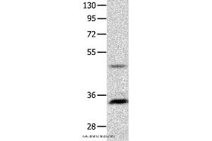Image no. 2 for anti-Melanocortin 1 Receptor (MC1R) antibody (ABIN2426175)