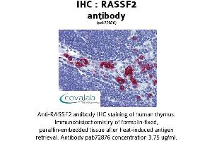 Image no. 1 for anti-Ras Association (RalGDS/AF-6) Domain Family Member 2 (RASSF2) (N-Term) antibody (ABIN1738748)