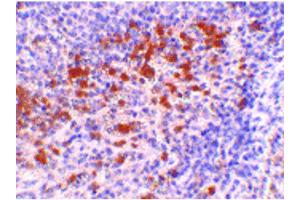 Image no. 1 for anti-Cathelicidin Antimicrobial Peptide (CAMP) (C-Term) antibody (ABIN6655148)