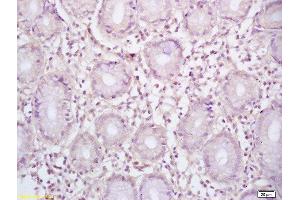 Image no. 2 for anti-B-Cell CLL/lymphoma 6 (BCL6) (AA 501-600) antibody (ABIN749843)