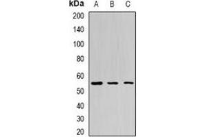 Image no. 2 for anti-Bactericidal/Permeability Increasing Protein (BPI) antibody (ABIN2966475)