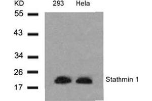Image no. 3 for anti-Stathmin 1 (STMN1) (Ser24) antibody (ABIN197454)