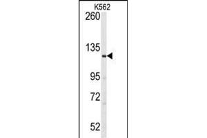 LATS1 antibody  (N-Term)