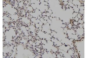 ABIN6273782 at 1/100 staining Mouse lung tissue by IHC-P.