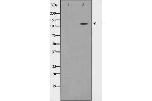 Image no. 3 for anti-TAF4 RNA Polymerase II, TATA Box Binding Protein (TBP)-Associated Factor, 135kDa (TAF4) antibody (ABIN6265437)
