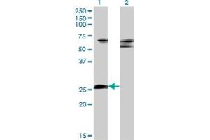 Western Blot analysis of ZNF266 expression in transfected 293T cell line by ZNF266 monoclonal antibody (M02), clone 4G5.