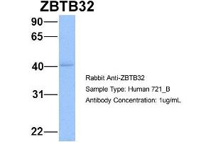 Image no. 1 for anti-Zinc Finger and BTB Domain Containing 32 (ZBTB32) (N-Term) antibody (ABIN2777470)