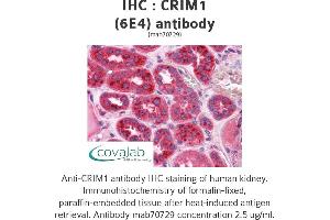 Image no. 2 for anti-Cysteine Rich Transmembrane BMP Regulator 1 (Chordin-Like) (CRIM1) (AA 36-146) antibody (ABIN1723586)