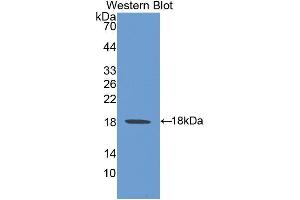 anti-Heat Shock 105kDa/110kDa Protein 1 (HSPH1) (AA 595-733) antibody