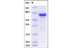 Image no. 1 for Aldolase B, Fructose-Bisphosphate (ALDOB) (AA 2-364) protein (GST tag) (ABIN2005561)