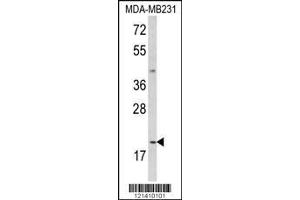Image no. 1 for anti-Interleukin 12 alpha (IL12A) (AA 168-195), (C-Term) antibody (ABIN652744)