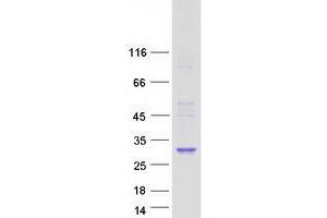 Image no. 1 for Phosphatidylinositol Glycan L (PIGL) protein (Myc-DYKDDDDK Tag) (ABIN2728889)
