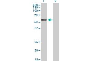 anti-Zinc Finger Protein 165 (ZNF165) (AA 1-485) antibody