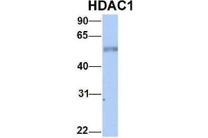 Image no. 5 for anti-Histone Deacetylase 1 (HDAC1) (Middle Region) antibody (ABIN2779587)