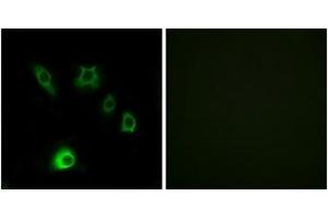 Image no. 2 for anti-Fibroblast Growth Factor 18 (FGF18) (AA 151-200) antibody (ABIN1534406)