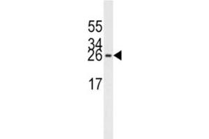 Image no. 4 for anti-Eukaryotic Translation Initiation Factor 4E (EIF4E) antibody (ABIN3028644)