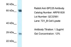 Image no. 1 for anti-SPC25, NDC80 Kinetochore Complex Component, Homolog (SPC25) (Middle Region) antibody (ABIN2788919)