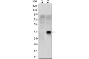 Image no. 6 for anti-Oligodendrocyte Lineage Transcription Factor 2 (OLIG2) antibody (ABIN1845900)