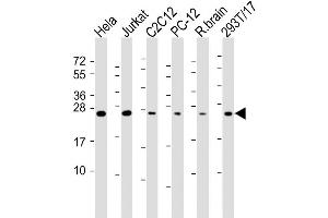 Image no. 2 for anti-RAB11A, Member RAS Oncogene Family (RAB11A) antibody (ABIN4913381)