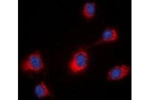 Image no. 1 for anti-Midline 1 (MID1) (N-Term) antibody (ABIN2957667)