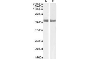 Image no. 1 for anti-Retinoic Acid Receptor, alpha (RARA) (C-Term) antibody (ABIN185366)