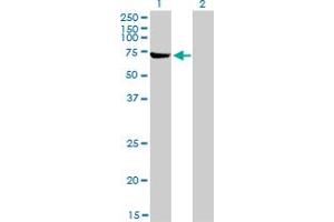 Image no. 3 for anti-ATP-Binding Cassette, Sub-Family F (GCN20), Member 2 (ABCF2) (AA 1-110) antibody (ABIN564348)