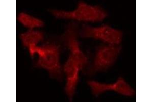Image no. 1 for anti-RAB40B, Member RAS Oncogene Family (RAB40B) (C-Term) antibody (ABIN6259258)