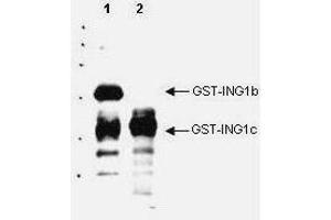 Western blot analysis is shown using  Affinity Purified anti-p33 ING1 antibody to detect over expressed Human ING1 present in cell nuclear extracts.
