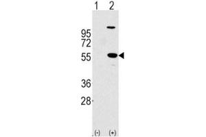 Image no. 2 for anti-Aldehyde Dehydrogenase 1 Family, Member A1 (ALDH1A1) (AA 302-331) antibody (ABIN3029894)