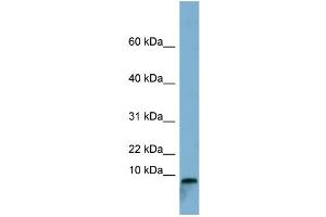 Image no. 1 for anti-T-Cell Leukemia Translocation Altered (TCTA) (Middle Region) antibody (ABIN2783859)