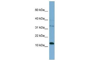 Image no. 1 for anti-Pleckstrin Homology-Like Domain, Family A, Member 2 (PHLDA2) (Middle Region) antibody (ABIN634590)