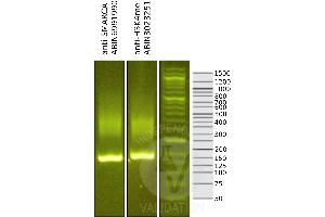 Image no. 1 for anti-SWI/SNF Related, Matrix Associated, Actin Dependent Regulator of Chromatin, Subfamily A, Member 4 (SMARCA4) (AA 1420-1470), (C-Term) antibody (ABIN6991990)