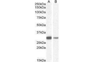 Image no. 4 for anti-NAD(P)H Dehydrogenase, Quinone 1 (NQO1) (C-Term) antibody (ABIN184714)