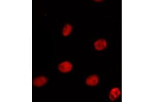 Image no. 1 for anti-PRP38 Pre-mRNA Processing Factor 38 (Yeast) Domain Containing A (PRPF38A) (Internal Region) antibody (ABIN6259333)