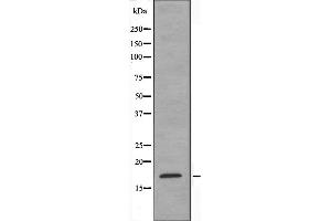 Image no. 1 for anti-CD160 (CD160) (Internal Region) antibody (ABIN6257994)