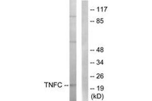 Image no. 2 for anti-Lymphotoxin beta (TNF Superfamily, Member 3) (LTB) (AA 181-230) antibody (ABIN1533839)