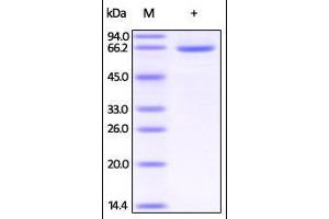 Image no. 2 for Human Serum Albumin (HSA) (AA 25-609) protein (His tag) (ABIN2181228)
