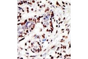 Image no. 1 for anti-Myeloid/lymphoid Or Mixed-Lineage Leukemia (MLL) (C-Term) antibody (ABIN356674)