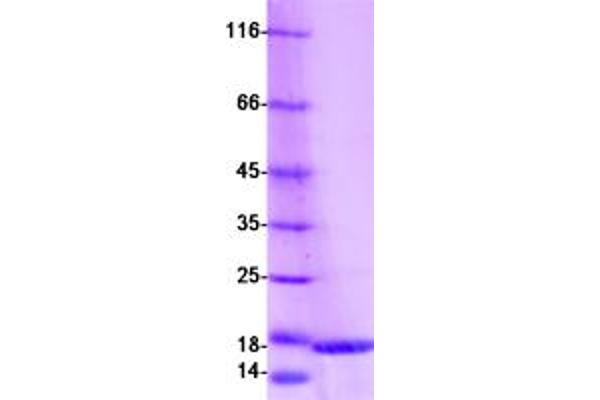 S100 Calcium Binding Protein A16 (S100A16) protein (Myc-DYKDDDDK Tag)