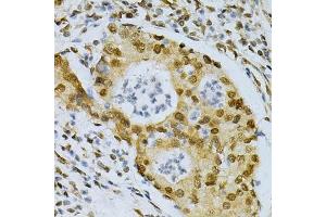 Image no. 8 for anti-ELAV (Embryonic Lethal, Abnormal Vision, Drosophila)-Like 1 (Hu Antigen R) (ELAVL1) antibody (ABIN3022231)