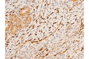 Image no. 3 for anti-Tumor Protein P73 (TP73) (pTyr99) antibody (ABIN6256817)