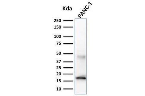 Elastase 3B antibody  (AA 82-238)