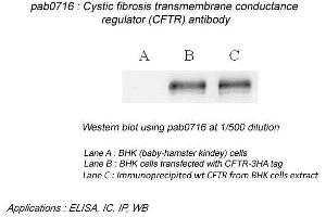 Image no. 2 for anti-Cystic Fibrosis Transmembrane Conductance Regulator (ATP-Binding Cassette Sub-Family C, Member 7) (CFTR) (N-Term) antibody (ABIN559718)