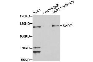 anti-Squamous Cell Carcinoma Antigen Recognized By T Cells (SART1) antibody
