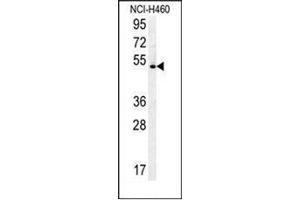 Image no. 3 for anti-DENN/MADD Domain Containing 1B (DENND1B) (AA 46-76), (N-Term) antibody (ABIN951885)