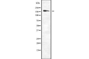Image no. 2 for anti-Death-Associated Protein Kinase 1 (DAPK1) (Internal Region) antibody (ABIN6261221)