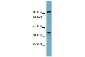 Image no. 1 for anti-serine Dehydratase (SDS) (Middle Region) antibody (ABIN2776892)