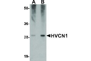Image no. 1 for anti-Hydrogen Voltage-Gated Channel 1 (HVCN1) (C-Term) antibody (ABIN6656814)