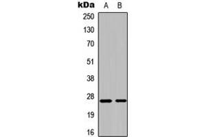 Image no. 2 for anti-Cytidine Monophosphate (UMP-CMP) Kinase 1, Cytosolic (CMPK1) (N-Term) antibody (ABIN2972737)