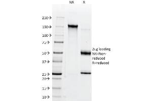 Image no. 1 for anti-Basigin (Ok Blood Group) (BSG) antibody (ABIN6940676)